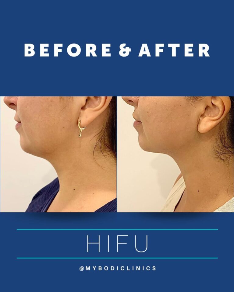 433760343_18020177843496204_8279840462308065957_n