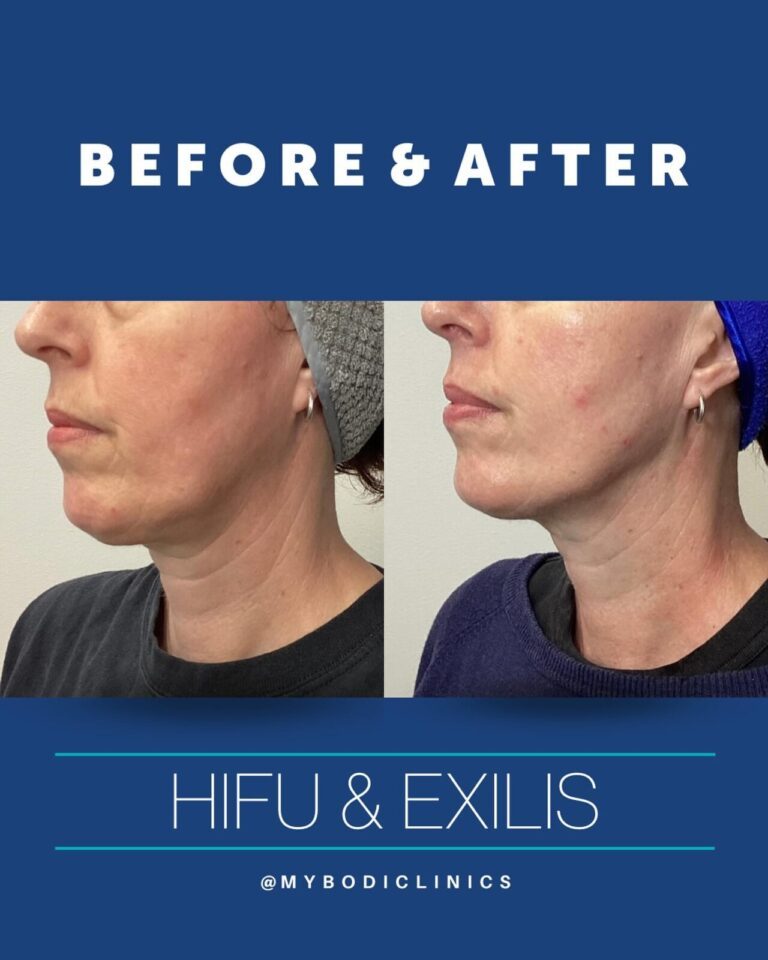 435232654_18022100492496204_698921334721859918_n