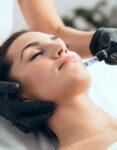 RF Microneedling