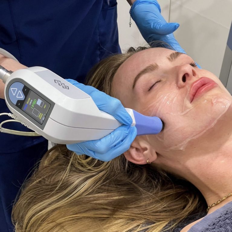 Exilis Skin Rejuvenation service