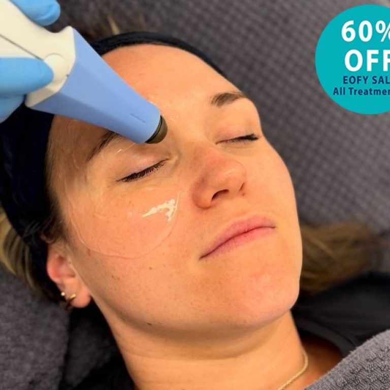 Skin Rejuvenation & Tightening - Mybodi Clinics