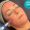 needling-3-50